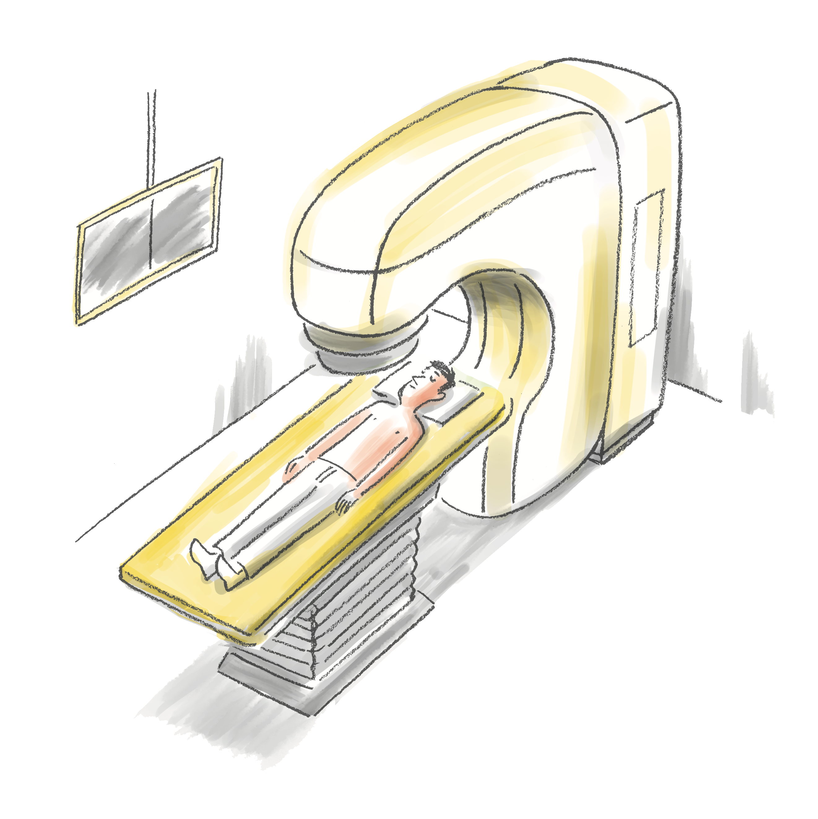 イラスト　放射線を当てる治療