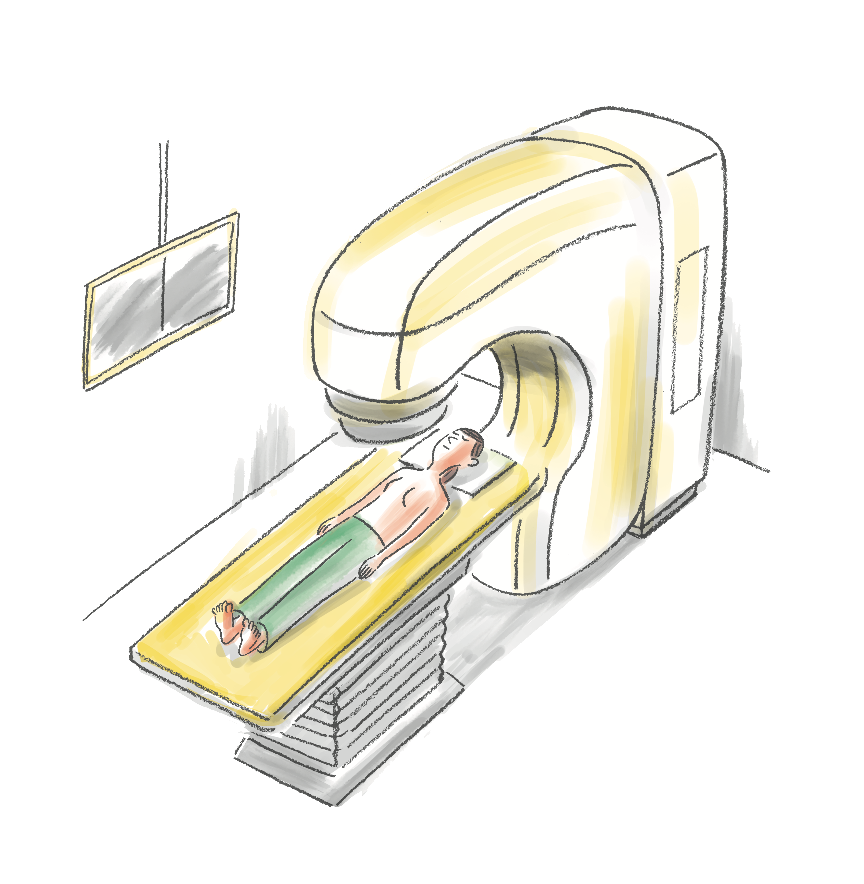 イラスト　放射線をあてる治療