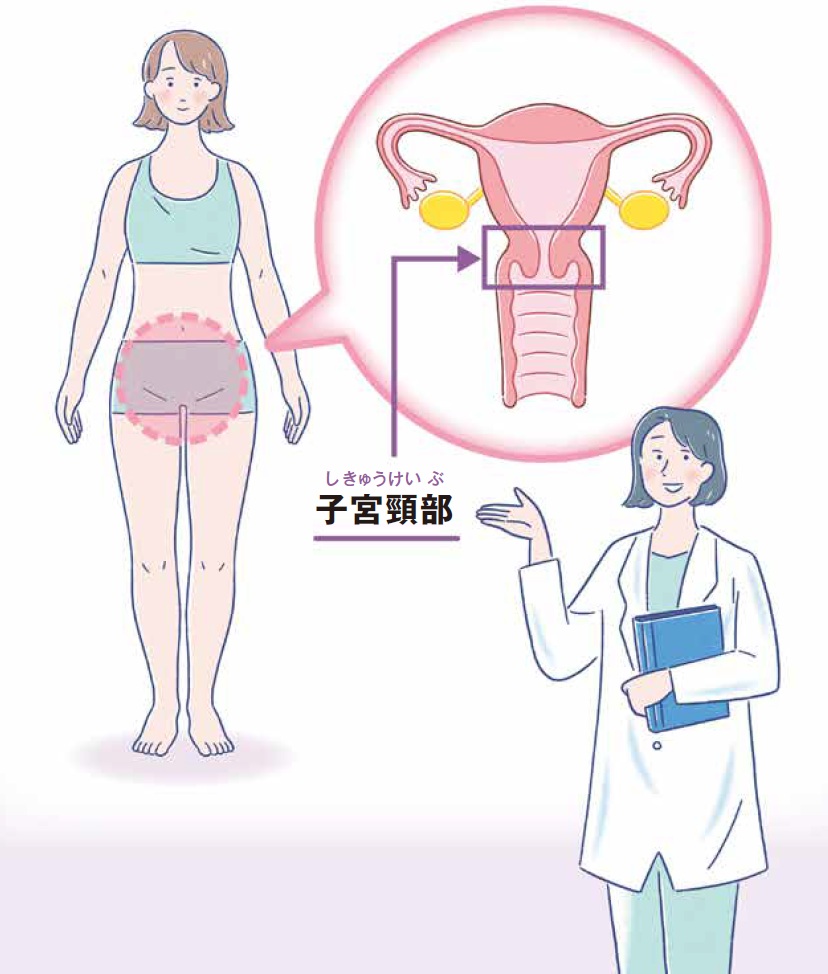イラスト　子宮頚部は、子宮の下から3分の1、膣につながる部分