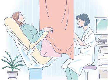 イラスト：子宮頸がん検査