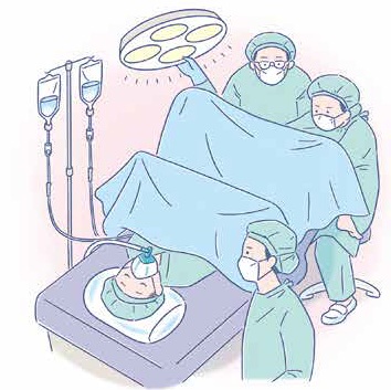 イラスト：手術