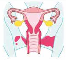 イラスト：三期