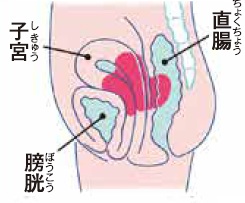 イラスト：四期。直腸、子宮、膀胱